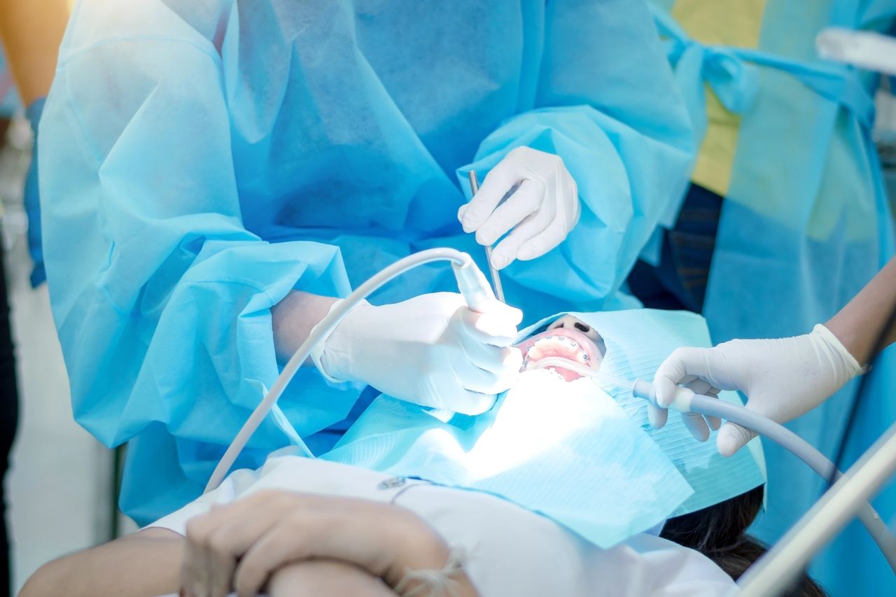 How is Wisdom Teeth Removal Performed?