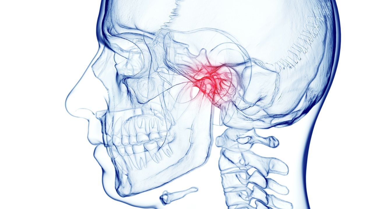 Botox injections for Temporomandibular disorders (TMDs) - oral surgeon in Melbourne