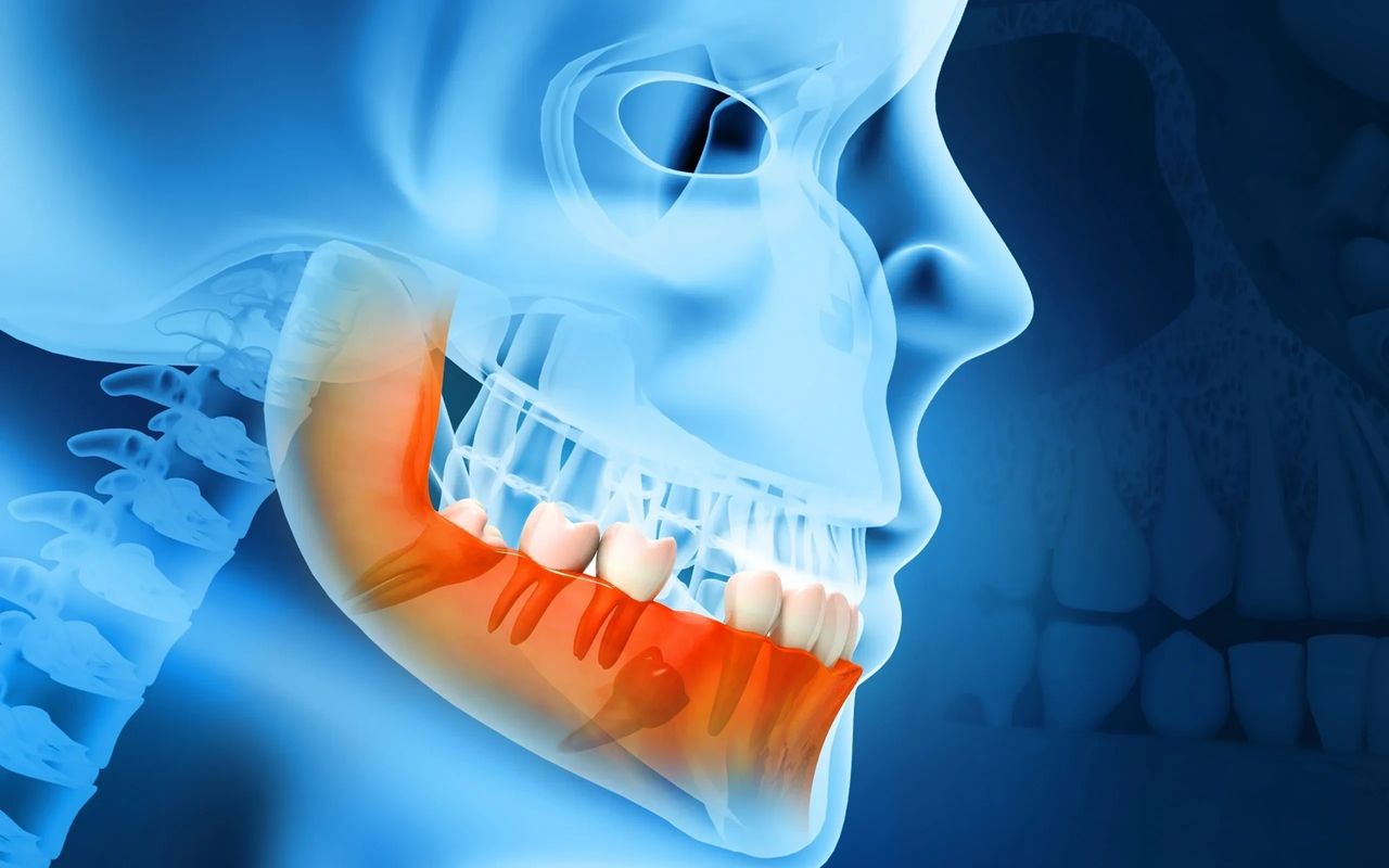 Exposure of teeth - oral surgeon in Melbourne